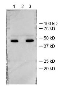 FBPase1 | Fructose-1,6-bisphosphatase 1, chloroplastic (chloroplastic marker in photosynthetic tissues) in the group Antibodies Plant/Algal / Arabidopsis thaliana at Agrisera AB (Antibodies for research) (AS19 4319)